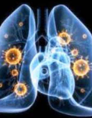 ILD E MALATTIE REUMATICHIE